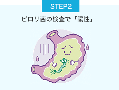 STEP2 ピロリ菌の検査で「陽性」 