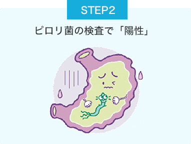 STEP2 ピロリ菌の検査で「陽性」