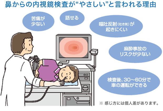 鼻からの内視鏡検査が”やさしい”といわれる理由　苦痛が少ない　話せる　嘔吐反射（吐き気）が起きにくい　麻酔事故のリスクが少ない　検査後、30〜60分で車の運転ができる